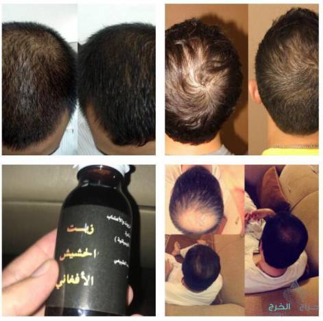 زيت الحشيش الأفغاني الاصلي 100%متوفر في جميع مناطق المملكه توصيل ف خ ساعه