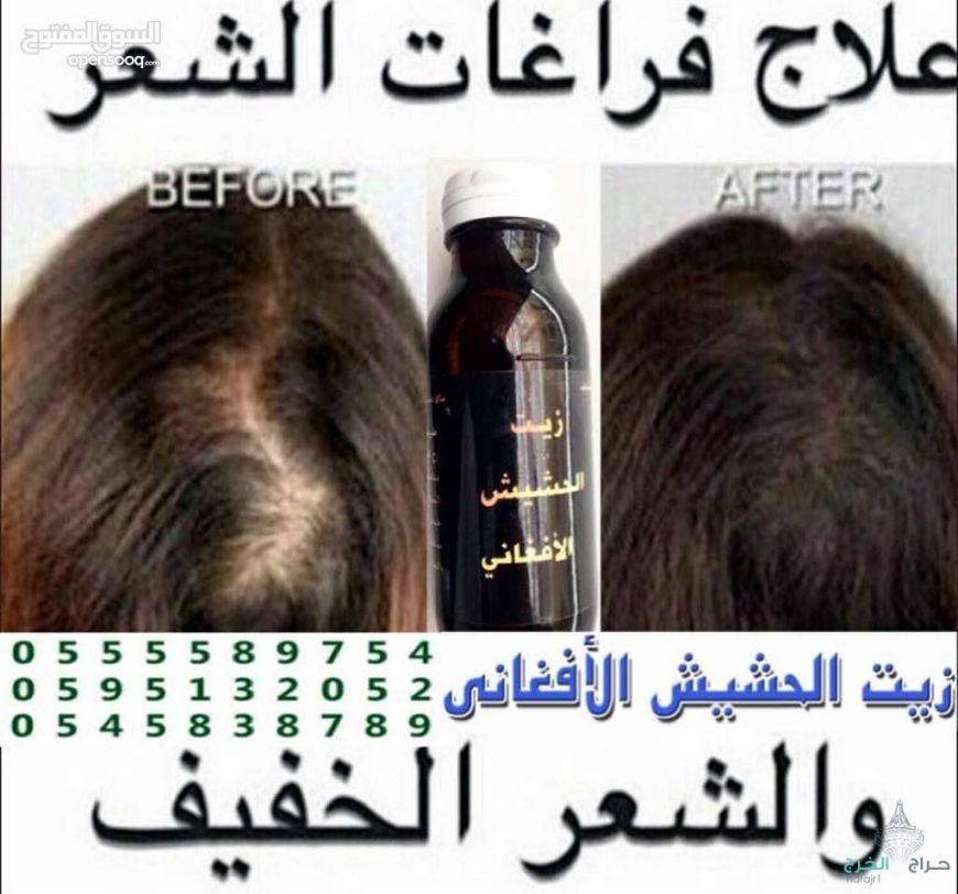 زيت الحشيش الأفغاني الاصلي 100%لجميع مشاكل الشعر ايقاف تساقط وانبات فراغات واطالة الشغر