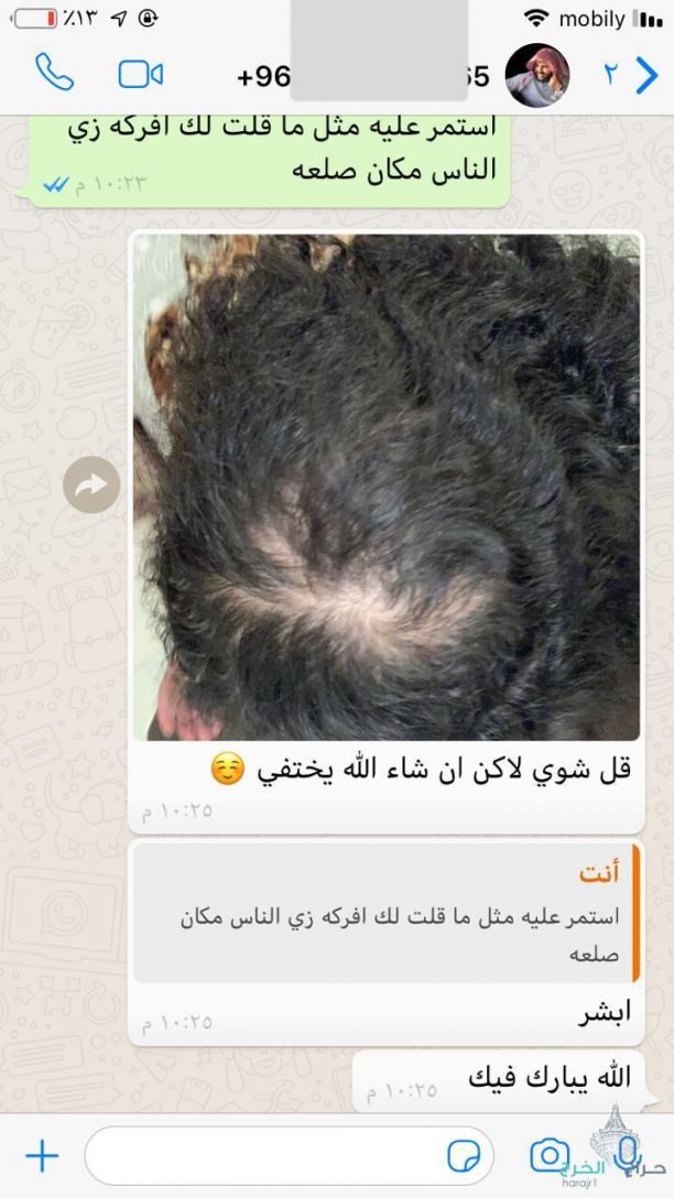 زيت الحشيش الأفغاني الاصلي 100%لجميع مشاكل الشعر ايقاف تساقط وانبات فراغات واطالة الشغر