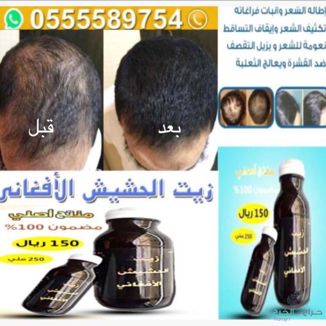 زيت الحشيش الأفغاني الاصلي 100%للتساقط وانبات فراغات وطالة الشعر منتج مضمون ومجرب