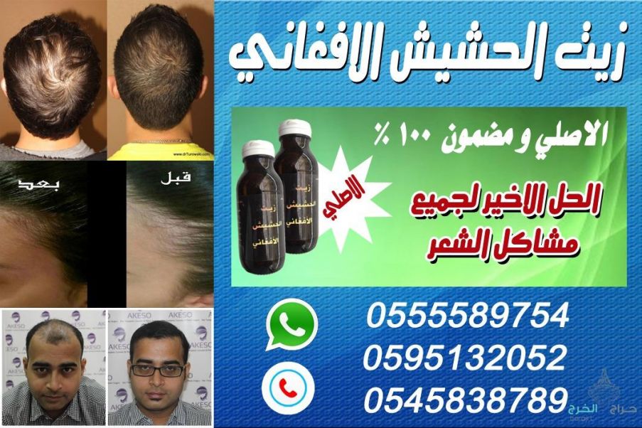 زيت الحشيش الأفغاني الاصلي 100%للتساقط وانبات فراغات وطالة الشعر منتج مضمون ومجرب