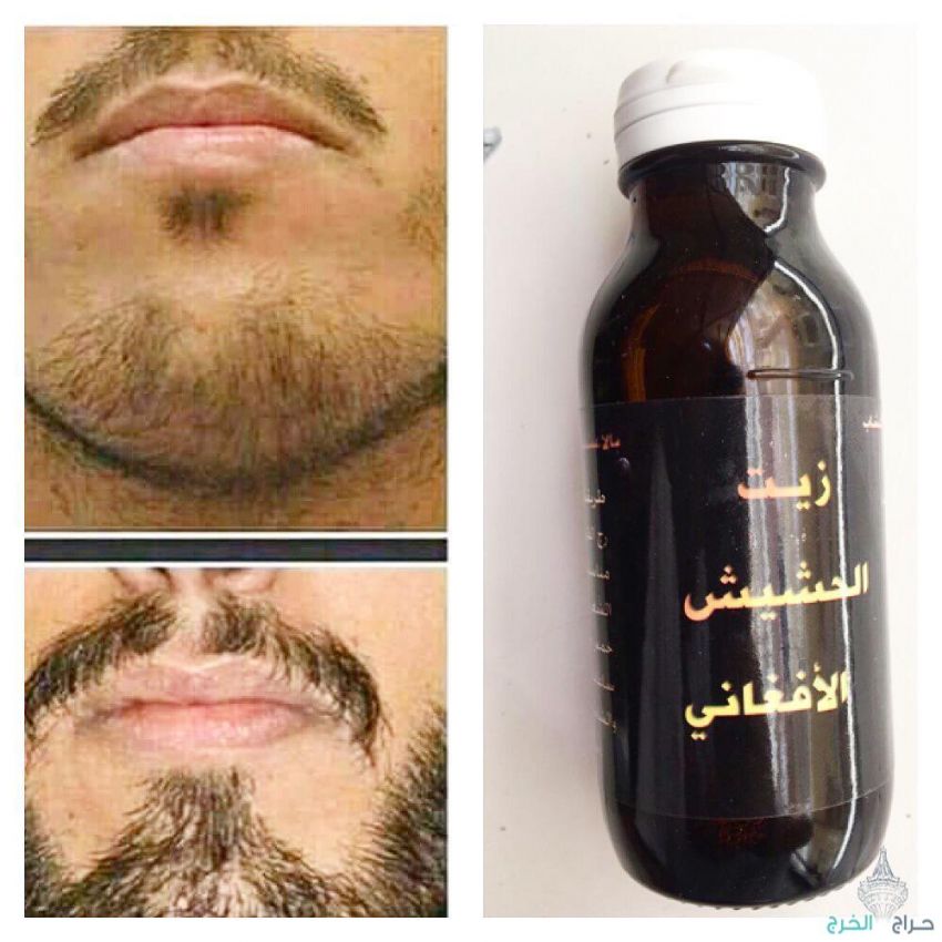 اقوى منتج للستاقط الشعر وانبات فراغات للرجال والنساء منتج مضمون مجرب ليسا اعلان ودعايه بل فعال مجرب