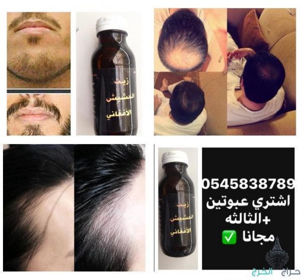 اقوى منتج للستاقط الشعر وانبات فراغات للرجال والنساء منتج مضمون مجرب ليسا اعلان ودعايه بل فعال مجرب