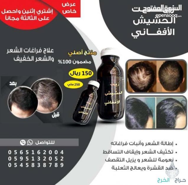 اقوى منتج للستاقط الشعر وانبات فراغات للرجال والنساء منتج مضمون مجرب ليسا اعلان ودعايه بل فعال مجرب
