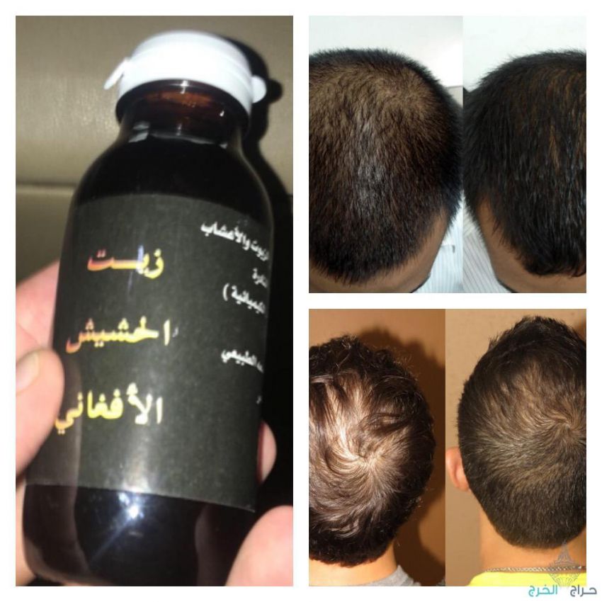 زيت الحشيش الأفغاني الاصلي 100%متوفر في جميع المناطق توصيل ف خ ساعه