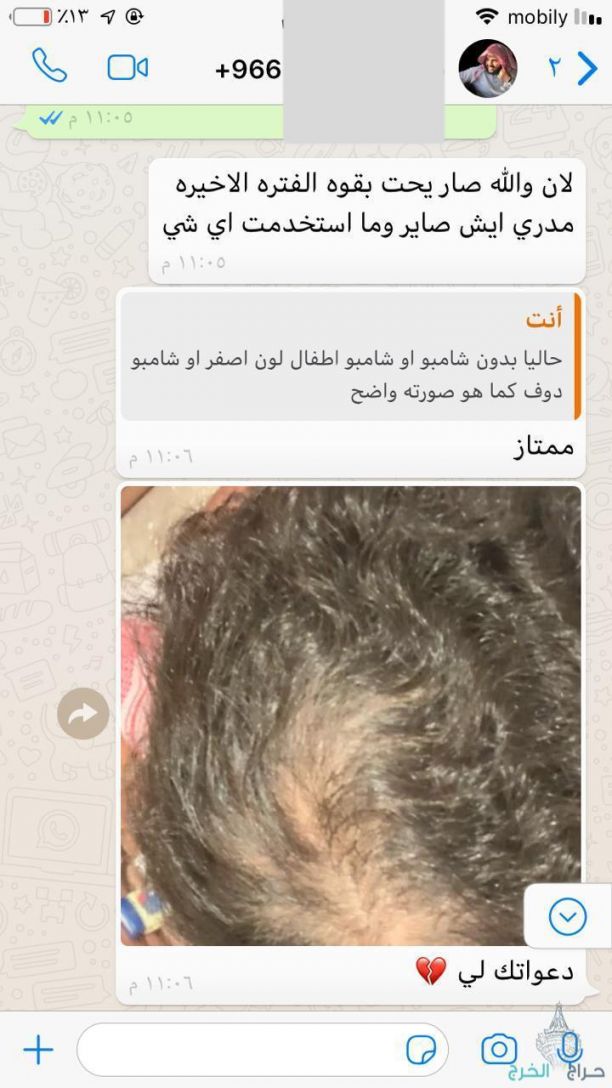 زيت الحشيش الأفغاني الاصلي 100%متوفر في جميع المناطق توصيل ف خ ساعه