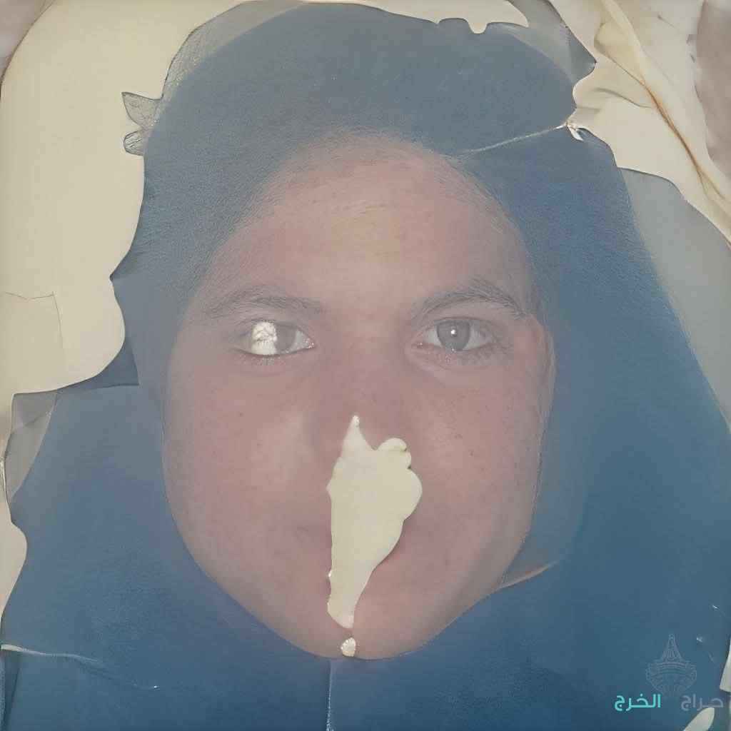 الدمام